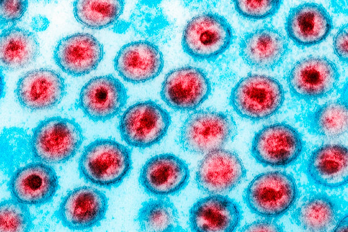 Dois Novos Casos de Possível Cura do HIV Anunciados em Conferência