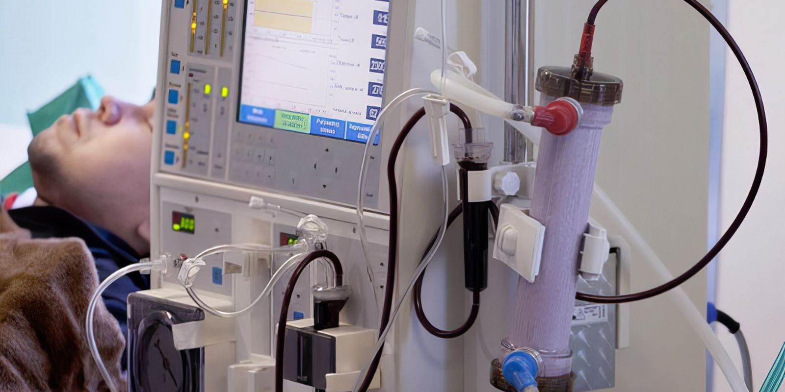 Diagnóstico precoces da doença renal crônica estão em risco