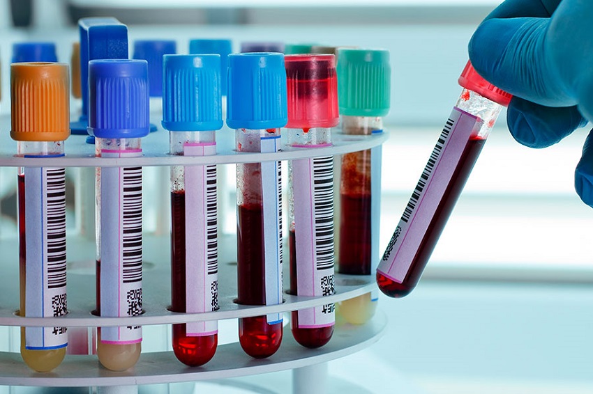 Estudo da Einstein identifica disparada das hepatites virais no Brasil