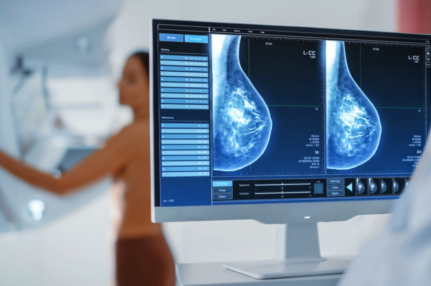 Estudo brasileiro inova com técnica menos invasiva para remoção completa de câncer de mama