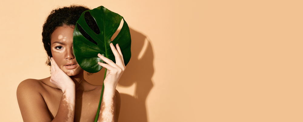 Argenx adquire Forte Biosciences por US$ 2,2 bi e fortalece atuação no vitiligo
