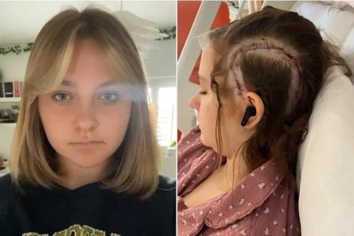 Inglês de 15 anos se torna paciente mais jovem a passar por cirurgia acordada