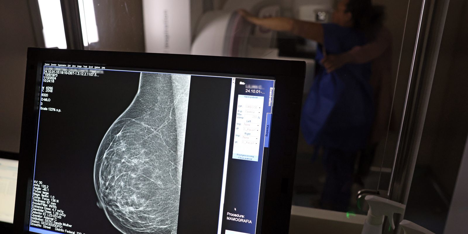 Plano de saúde cobrirá mamografia digital para todas as idades a partir de 1º de outubro