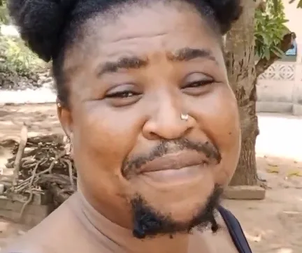 Woman With Excessive Facial Hair Embraces Different Look Despite Stigma