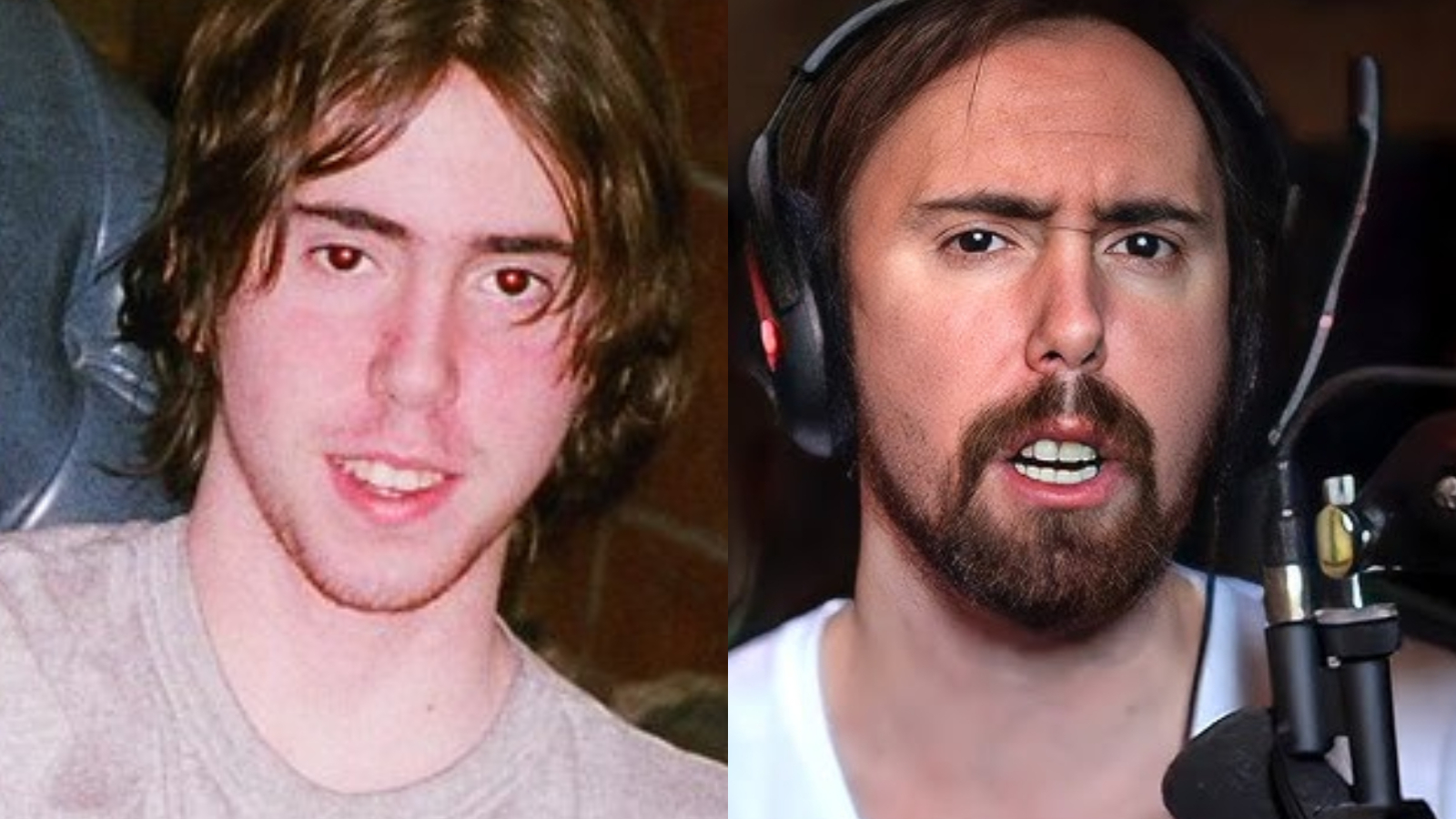 Asmongold Urges Viewers to Brush Their Teeth After Revealing Unfortunate Looks